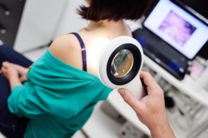 testing-for-melanoma