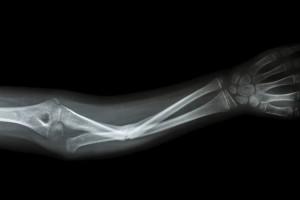shutterstock_182609801