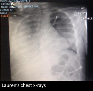 xrayfixed
